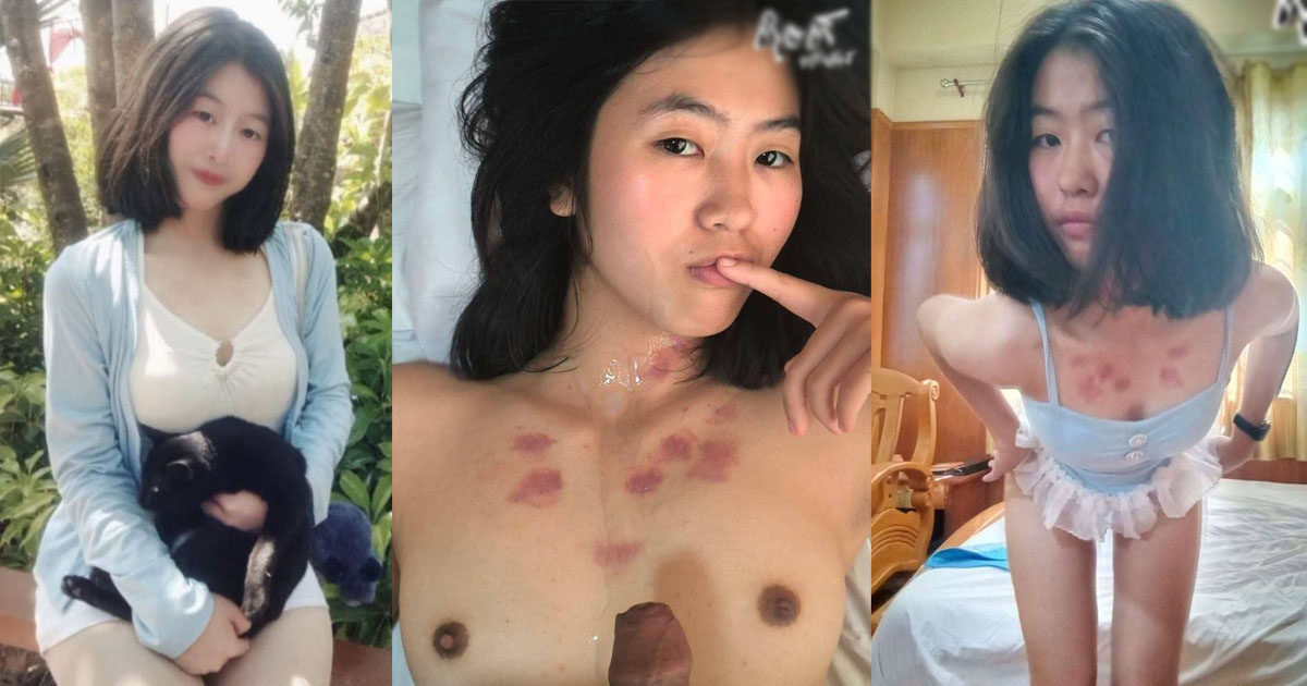 Hot Girl Covered in Love Bites